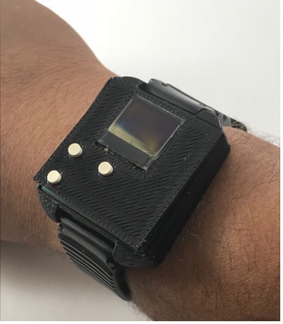 custom-designed smartwatch for monitoring heart rate, respiration, activity, and other relevant physiological signals.