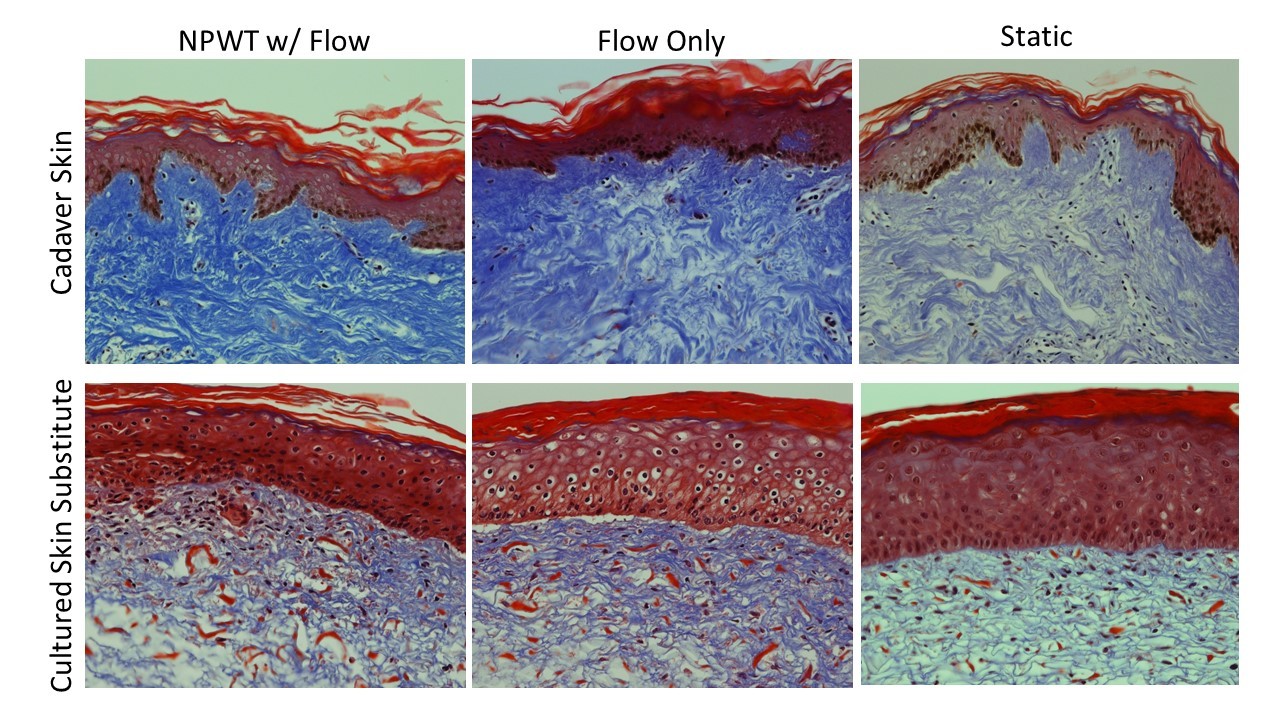 NPWT Masson's Trichrome depiction