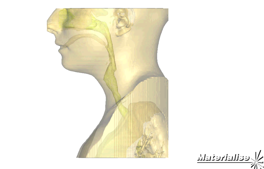 Diagram of a human depicting the mechanisms  of voice production