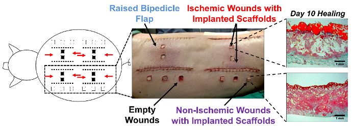 Diagram of wound healing