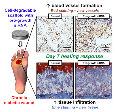 Diagram of diabetic wound healing process