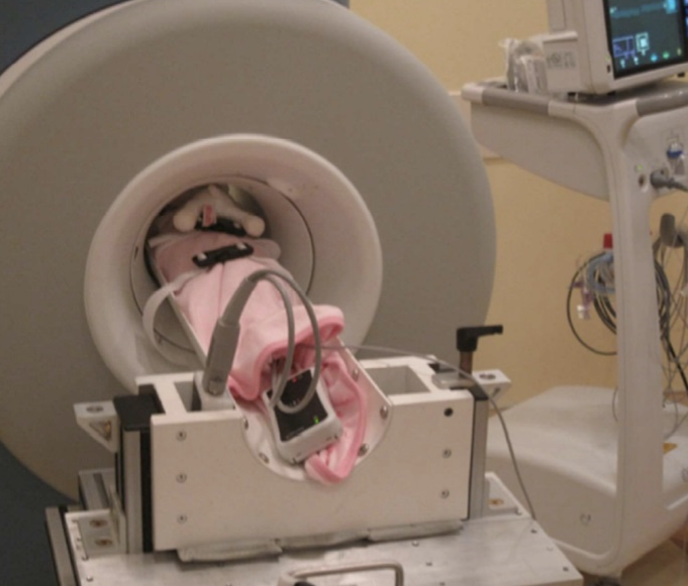 Baby MRI machine in NICU