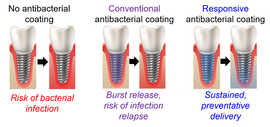 Diagram of dental implants