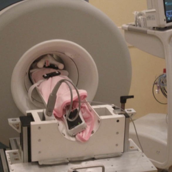 Baby MRI machine in NICU