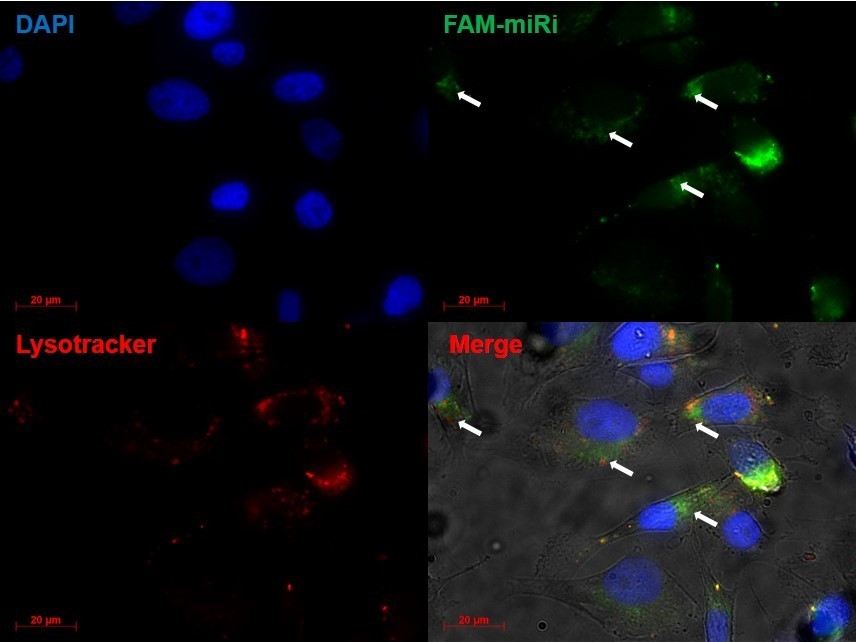 Endosomal escape of hybrid nanoparticles